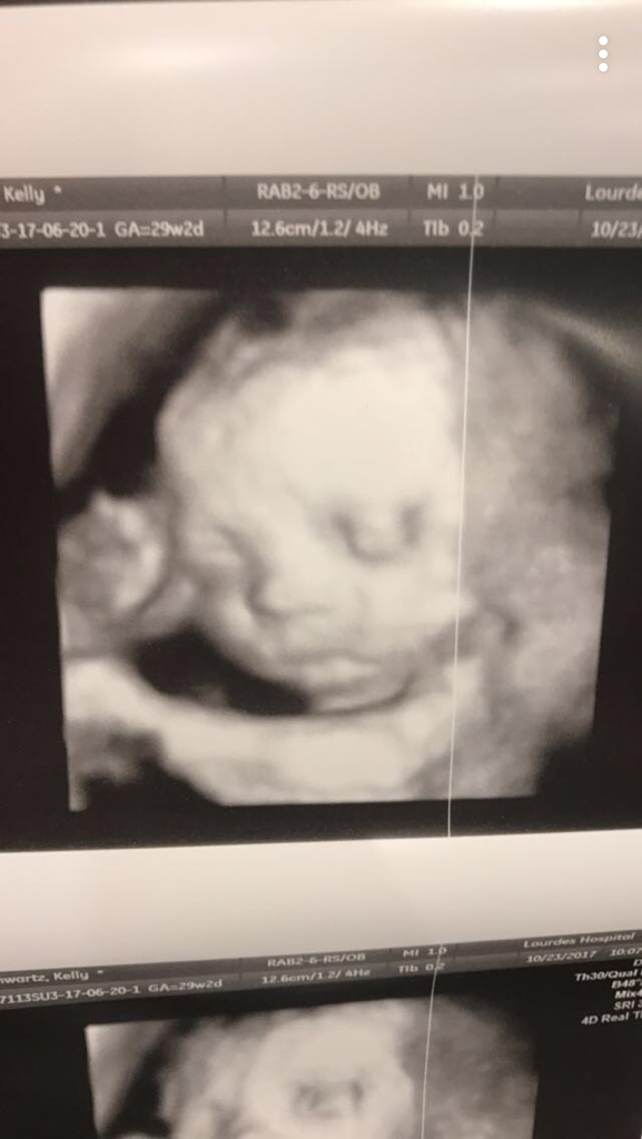 4D ultrasound 28 weeks pregnant